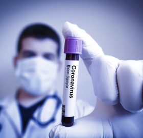 उपत्यकामा कोरोना संक्रमण पत्ता लगाउन समुदायमा परीक्षण