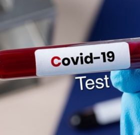 पर्वतमा थप एक महिलामा कोरोना संक्रमण पुष्टि , गण्डकीमा १३ जना थपिए