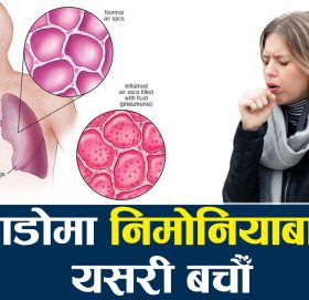 जाडोमा निमोनिया हुने सम्भावना अधिक, यस्ता छन् बच्ने उपाय