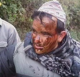 भ्रष्टाचार गरेको भन्दै वडा अध्यक्ष र सचिवलाई  कालोमोसो