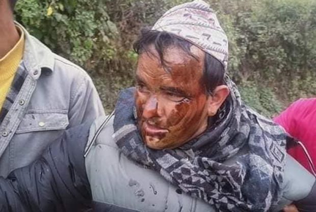 भ्रष्टाचार गरेको भन्दै वडा अध्यक्ष र सचिवलाई  कालोमोसो