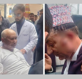 अर्थमन्त्री पौडेललाई डिस्चार्ज गरिने, प्रमुख आचार्य केही दिन अस्पतालमै रहने